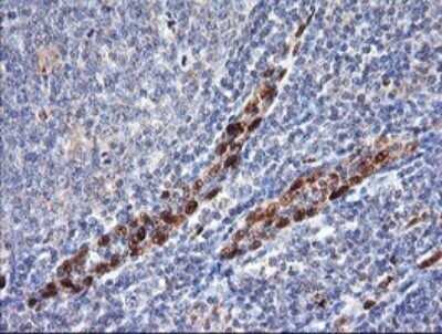 Immunohistochemistry: ERG Antibody (OTI4H7) - Azide and BSA Free [NBP2-70686]