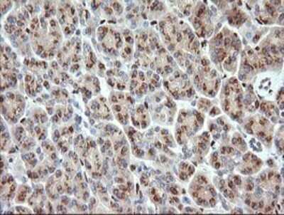 Immunohistochemistry: ERG Antibody (OTI4H7) [NBP2-45520]