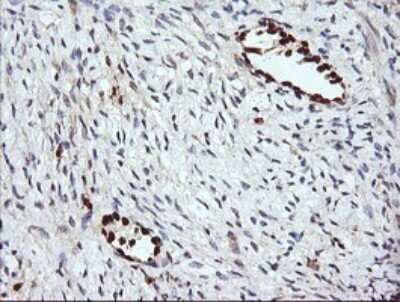 Immunohistochemistry: ERG Antibody (OTI4H7) [NBP2-45520]