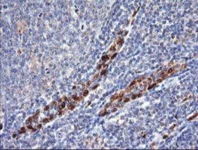 Immunohistochemistry: ERG Antibody (OTI4H7) [NBP2-45520]