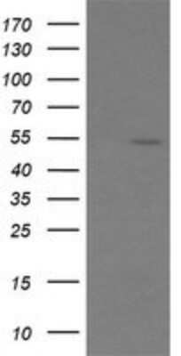 Western Blot: ERG Antibody (OTI4H7) [NBP2-45520]