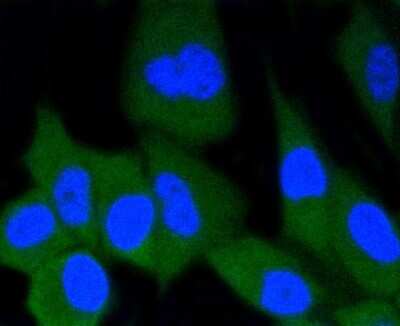 Immunocytochemistry/ Immunofluorescence: ERG Antibody (SP06-04) [NBP2-67375]