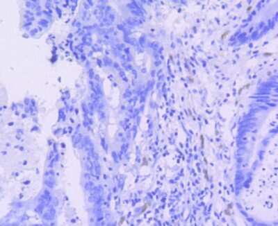 Immunohistochemistry-Paraffin: ERG Antibody (SP06-04) [NBP2-67375]