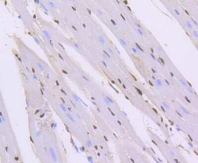 Immunohistochemistry-Paraffin: ERG Antibody (SP06-04) [NBP2-67375]