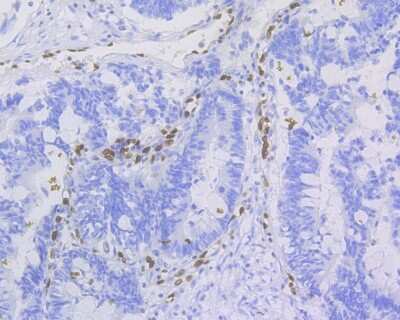 Immunohistochemistry-Paraffin: ERG Antibody (SP06-04) [NBP2-67375]