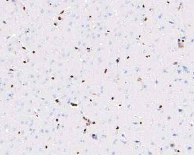 Immunohistochemistry-Paraffin: ERG Antibody (SP06-04) [NBP2-67375]