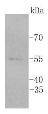 Western Blot: ERG Antibody (SP06-04) [NBP2-67375]