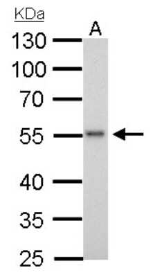 Western Blot: ERG Antibody [NBP1-31370]