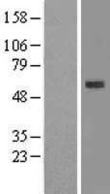 Western Blot: ERG Overexpression Lysate [NBL1-10328]