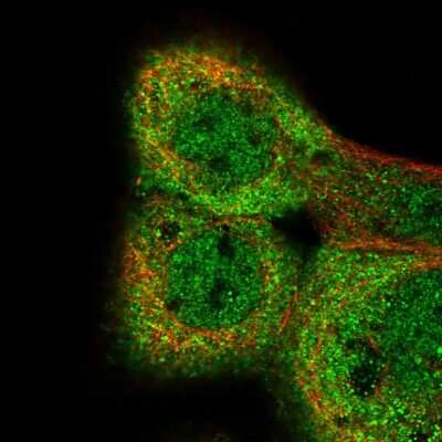 Immunocytochemistry/ Immunofluorescence: ERI3 Antibody [NBP2-48591]