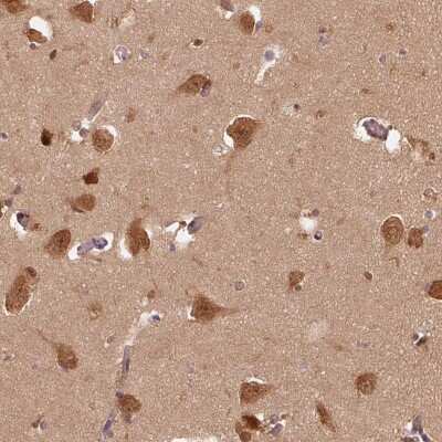 Immunohistochemistry-Paraffin: ERI3 Antibody [NBP2-48591]