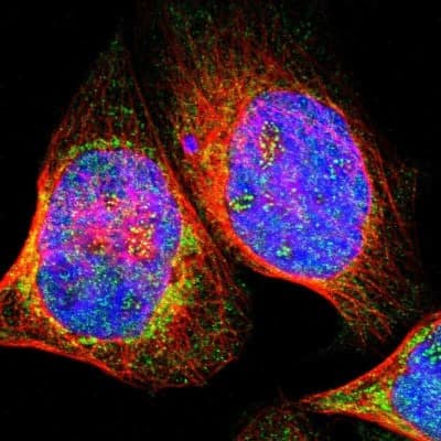 Immunocytochemistry/ Immunofluorescence: ERICH1 Antibody [NBP1-90952]