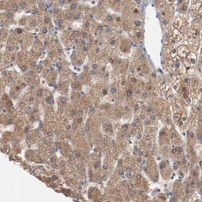Immunohistochemistry-Paraffin: ERICH1 Antibody [NBP1-90952]