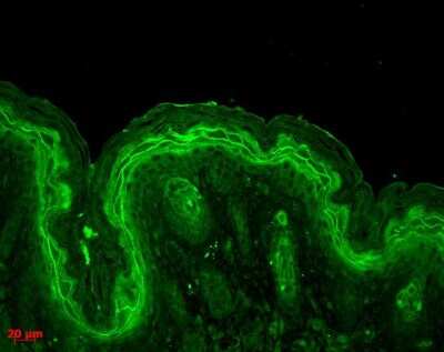 Immunohistochemistry: ERK1/2 Antibody [NB110-96887]