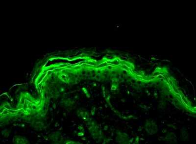 Immunohistochemistry-Paraffin: ERK1/2 Antibody [NB110-96887]