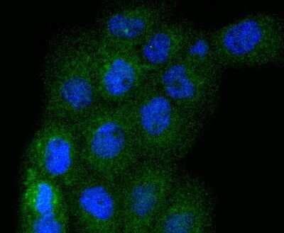 Immunocytochemistry/ Immunofluorescence: ERK1/2 Antibody (SP05-09) [NBP2-67373]