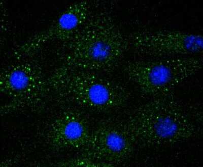 Immunocytochemistry/ Immunofluorescence: ERK1/2 Antibody (SP05-09) [NBP2-67373]