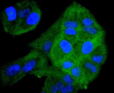 Immunocytochemistry/ Immunofluorescence: ERK1/2 Antibody (SP05-09) [NBP2-67378]