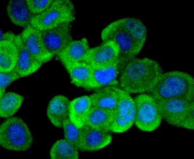 Immunocytochemistry/ Immunofluorescence: ERK1/2 Antibody (SP05-09) [NBP2-67378]