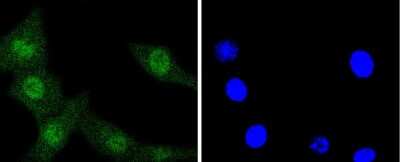 Immunocytochemistry/ Immunofluorescence: ERK1/2 Antibody (SP05-09) [NBP2-67378]