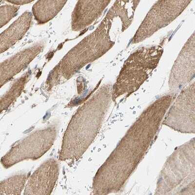 Immunohistochemistry-Paraffin: ERK1 Antibody [NBP1-84807]