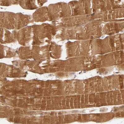 Immunohistochemistry-Paraffin: ERK1 Antibody [NBP1-84808]