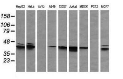 Western Blot: ERK1 Antibody (OTI4D7) [NBP2-45814]