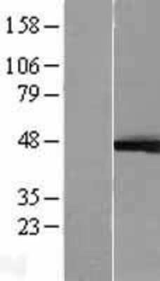 Western Blot: ERK1 Overexpression Lysate [NBL1-12877]