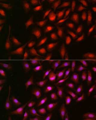 Immunocytochemistry/ Immunofluorescence: ERK2 Antibody - Azide and BSA Free [NBP3-02974]