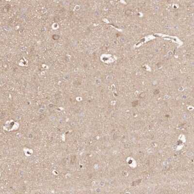 Immunohistochemistry-Paraffin: ERK2 Antibody [NBP1-87943]