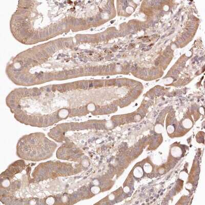 Immunohistochemistry-Paraffin: ERK2 Antibody [NBP1-87943]