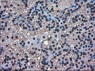 Immunohistochemistry: ERK2 Antibody (OTI6E5) - Azide and BSA Free [NBP2-71233]