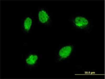Immunocytochemistry/ Immunofluorescence: ERK3/MAPK6 Antibody (1G6) [H00005597-M01]