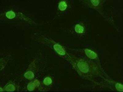 Immunocytochemistry/ Immunofluorescence: ERK3/MAPK6 Antibody (OTI5E1) [NBP1-47854]