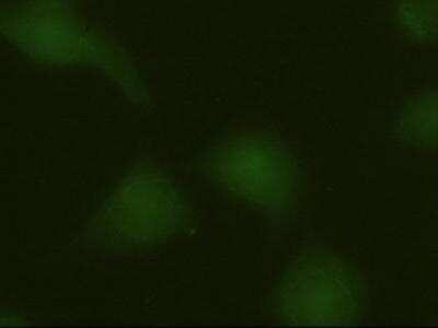 Immunohistochemistry-Paraffin: ERK3/MAPK6 Antibody (OTI5E1) [NBP1-47854]