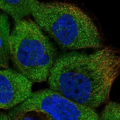 Immunocytochemistry/ Immunofluorescence: ERK3/MAPK6 Antibody [NBP1-84806]