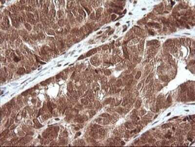 Immunohistochemistry: ERK4/MAPK4 Antibody (OTI2D7) - Azide and BSA Free [NBP2-71240]