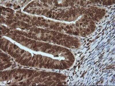 Immunohistochemistry: ERK4/MAPK4 Antibody (OTI2D7) [NBP2-45743]