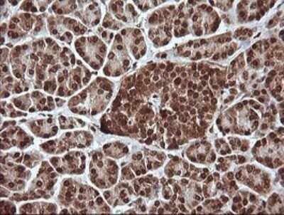 Immunohistochemistry: ERK4/MAPK4 Antibody (OTI2D7) [NBP2-45743]