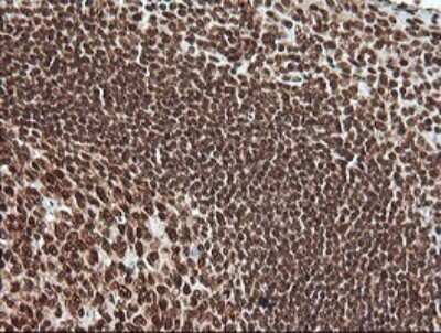 Immunohistochemistry: ERK4/MAPK4 Antibody (OTI2D7) [NBP2-45743]
