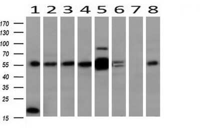Western Blot: ERK4/MAPK4 Antibody (OTI2D7) [NBP2-45743]