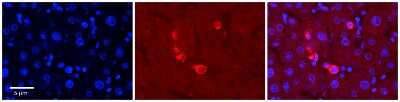 Immunohistochemistry-Paraffin: ERK5/BMK1 Antibody [NBP3-10647]