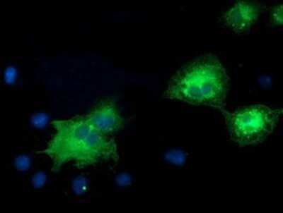 Immunocytochemistry/ Immunofluorescence: ERK5/BMK1 Antibody (OTI3H2) - Azide and BSA Free [NBP2-71243]