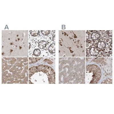 Immunohistochemistry-Paraffin: ERLEC1 Antibody [NBP1-86803]