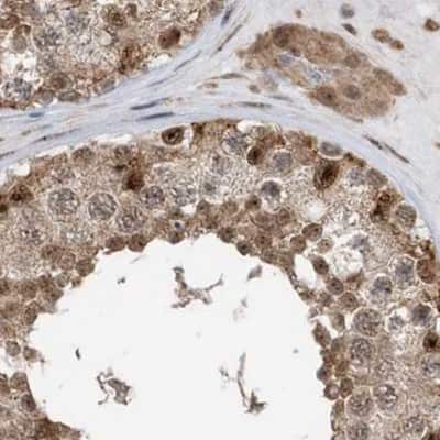 Immunohistochemistry-Paraffin: ERLEC1 Antibody [NBP1-86803]
