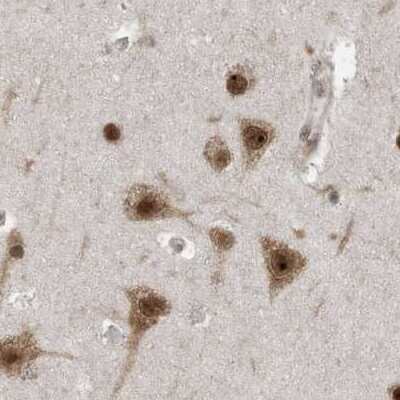 Immunohistochemistry-Paraffin: ERLEC1 Antibody [NBP1-86803]