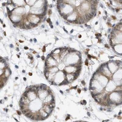 Immunohistochemistry-Paraffin: ERLEC1 Antibody [NBP1-86803]