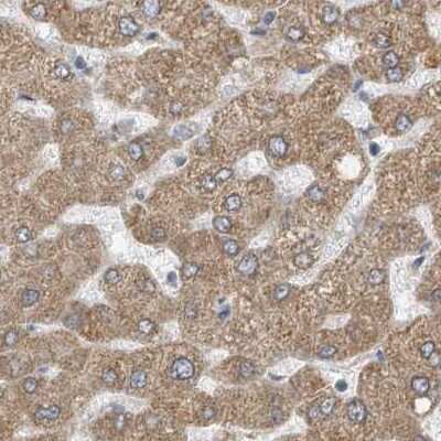 Immunohistochemistry-Paraffin: ERLEC1 Antibody [NBP1-86803]