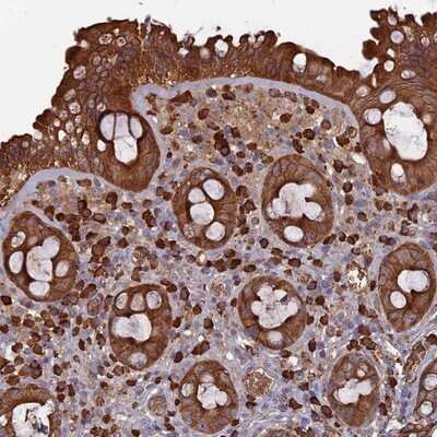 Immunohistochemistry-Paraffin: ERMAP Antibody [NBP1-87151]
