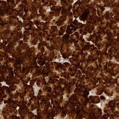 Immunohistochemistry-Paraffin: ERO1LB Antibody [NBP1-83961]